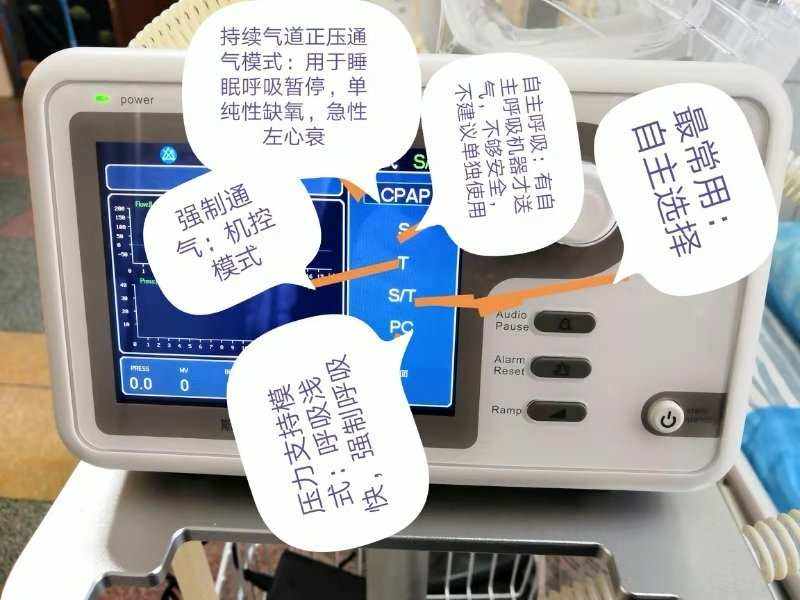 无创呼吸机适应症 无创呼吸机 无创呼吸机适应症 无创呼吸机